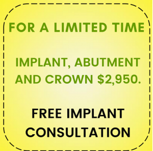 Dental Implant consultation