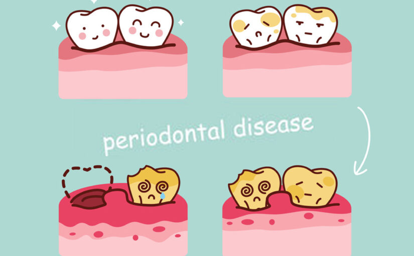 How to cure periodontal diseases