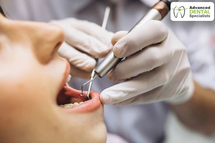 What Should You Expect During a Tooth Extraction?