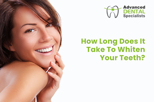 How Long Does It Take To Whiten Your Teeth?