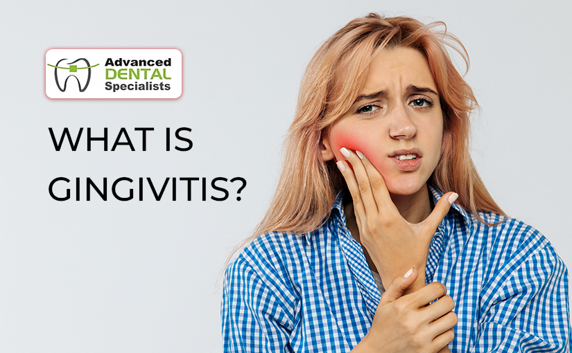What is Gingivitis