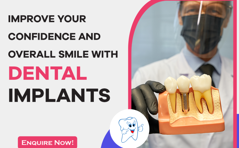Exploring the Pros and Cons of Dental Implants: A Comprehensive Guide