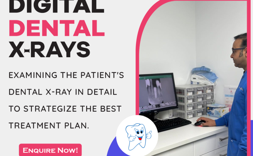 The Advantages of Digital X-Rays in Dentistry